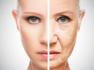 Causes of Aging Skin